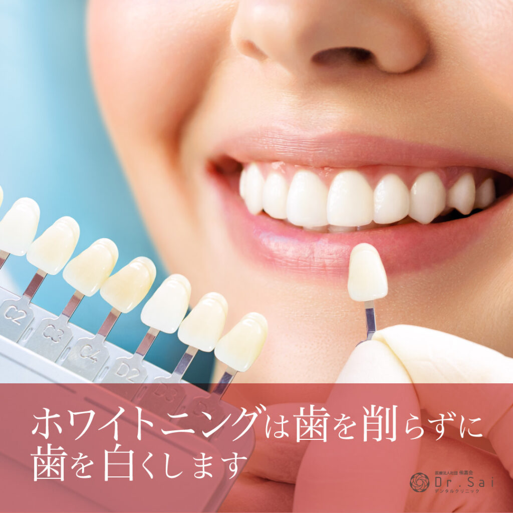 島田市　歯医者　ホワイトニング