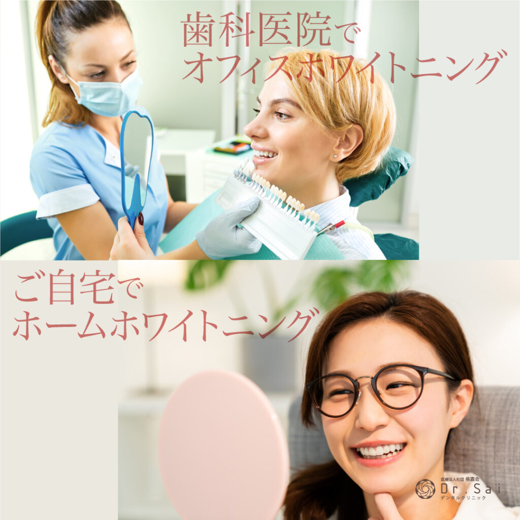 島田市　歯医者　ホワイトニング