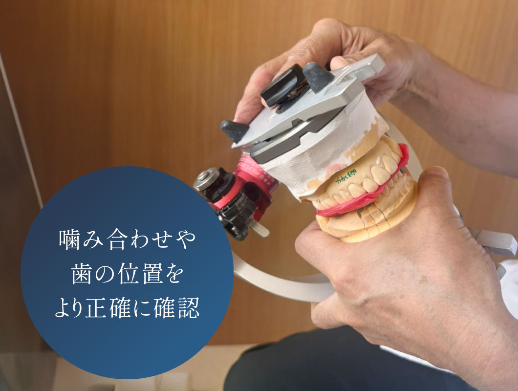 噛み合わせや歯の位置をより正確に確認