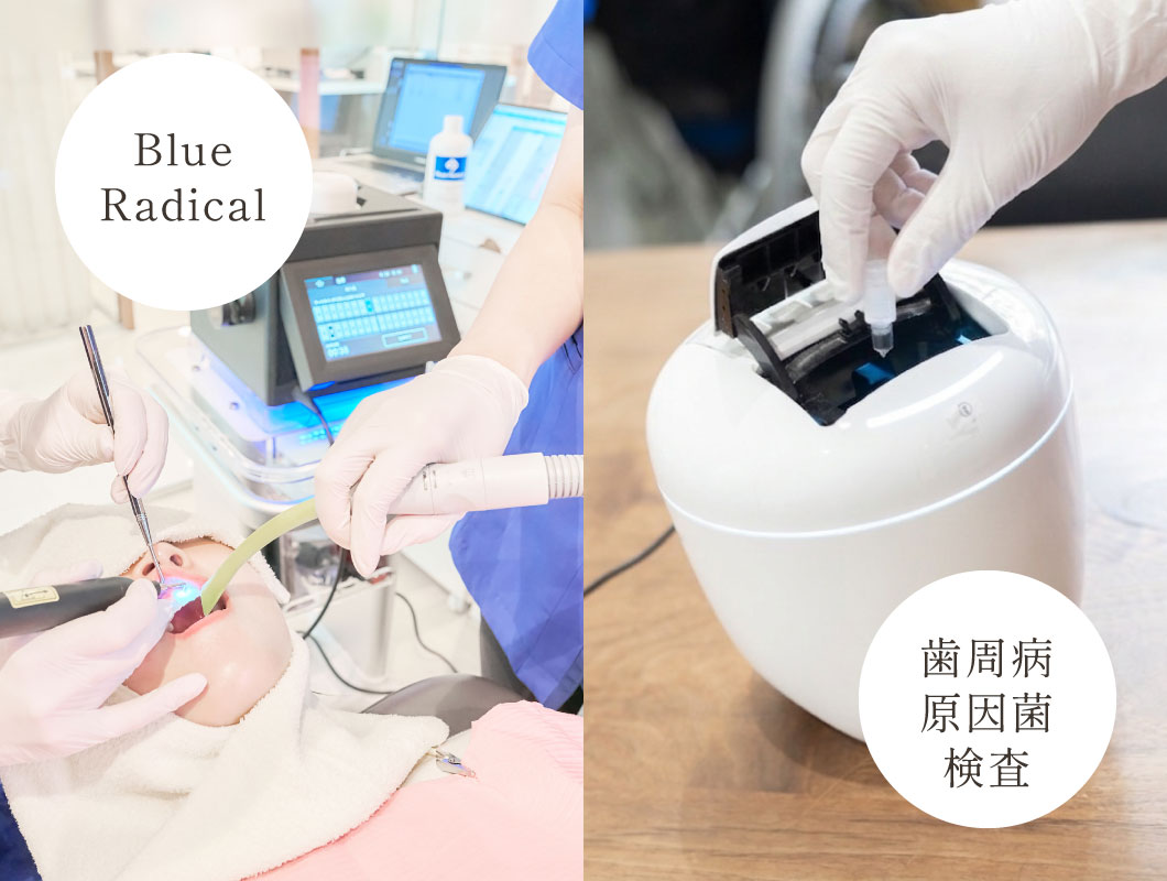 「BlueRadical」「歯周病原因菌検査」